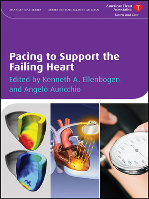 cover image of Pacing to Support the Failing Heart